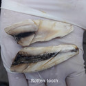 a rotten tooth